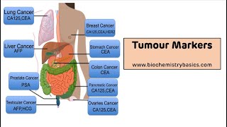 Tumour Markers  Tumour Markers Biochemistry [upl. by Smitt342]