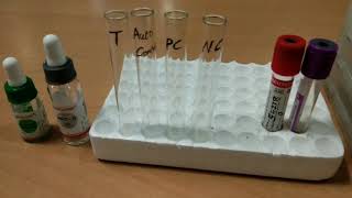 Indirect Coombs test by Tube method [upl. by Mcleod]