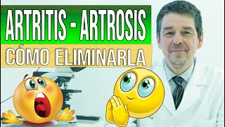 ¿Qué síntomas ocasiona la artritis psoriásica [upl. by Nohsyar]