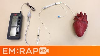 Placing a Transvenous Pacemaker [upl. by Eillit]