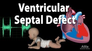 Overview of Heart Anatomy Tutorial [upl. by Noraha]