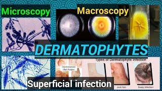 Fungal infectionFungal cultureFungal identificationDermatophytesDermatophytosisSTAR LABORATORY [upl. by Knox274]