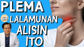 Plema sa Lalamunan Alisin Ito  By Doc Willie Ong 1075 [upl. by Atinar]