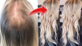 5 LIFE CHANGING HACKS FOR THIN amp FINE HAIR must watch [upl. by Glenden50]