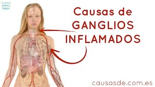 Causas de ganglios inflamados [upl. by Frangos]