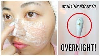 Instantly MELT BLACKHEADS w Vaseline  Plastic Wrap OVER NIGHT [upl. by Llerraj]