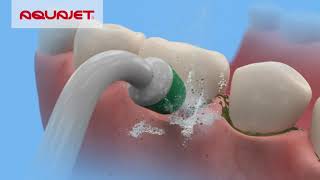 How to use an AQUAJET® oral dental irrigator [upl. by Swarts951]