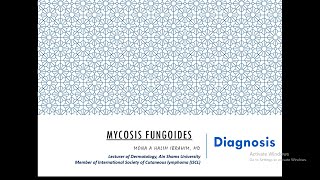 2 Diagnosis of Mycosis Fungoides [upl. by Asle466]