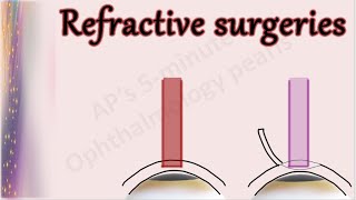 REFRACTIVE SURGERIES [upl. by Navets]