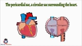 Cardiac Tamponade Pulsus Paradoxus [upl. by Rbma]