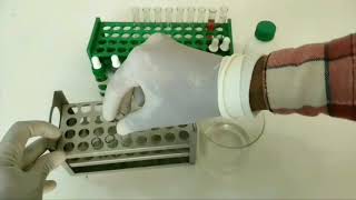 Indirect Coombs Test Principle and Procedure in Hindi [upl. by Surtemed]