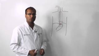 Full Procedure  Fiberoptic Laryngoscopy with Dr Hermsen [upl. by Ardnaiek119]