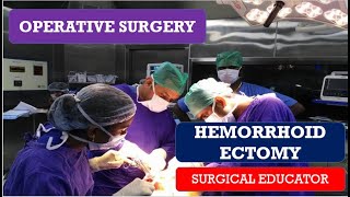 HEMORRHOIDECTOMYSTEP BY STEP OPERATIVE SURGERY [upl. by Beal359]