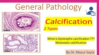 Pathological Calcification [upl. by Annice]