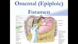 Omental Epiploic Foramen [upl. by Erotavlas358]