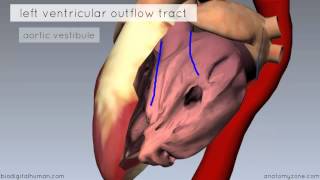 Ventricular Septal Defects by D Bailly  OPENPediatrics [upl. by Nagear87]