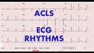 ACLS  ECG rhythm recognition amp management Part 1 [upl. by Abram]