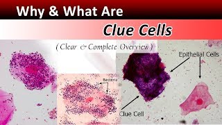 What Are Clue Cells  Clear amp Complete Overview [upl. by Enrev]