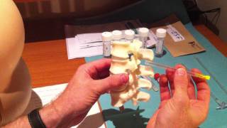 Lumbar Puncture Series  4 Lumbar Spine Anatomy and Needle Trajectory [upl. by Lunnete]