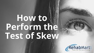 How to Perform the Test of Skew for Vertigo [upl. by Lowson]