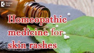 Homeopathic medicine for skin rashes  Dr Surekha Tiwari [upl. by Itirahc]