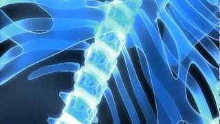 Lumbar Degenerative Disc Disease Part 1 Symptoms and Imaging [upl. by Shandeigh944]