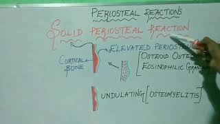 PERIOSTEAL BONE REACTIONS [upl. by Smart681]