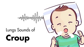 Sounds of Croup Laryngotracheitis  Lung Sounds  MEDZCOOL [upl. by Phillada]