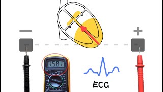 12 Lead ECG Placement example [upl. by Elleimac]