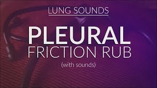 Pleural Friction Rub  Pleural Rub [upl. by Ahter]