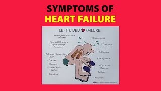 Symptoms of Heart Failure [upl. by Ardnuassak]