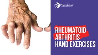 HOW I CURED MY RHEUMATOID ARTHRITIS [upl. by Yllehs]