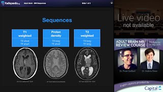 Limbic Neuroanatomy Video Lab  Brain Dissections [upl. by Pillihp]