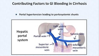 Esophageal Varices and Variceal Hemorrhage [upl. by Ahsuoj]