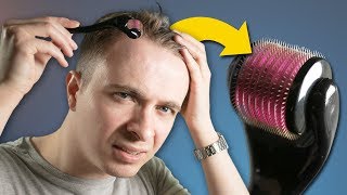 Microneedling My Scalp For Balding [upl. by Aynnek]