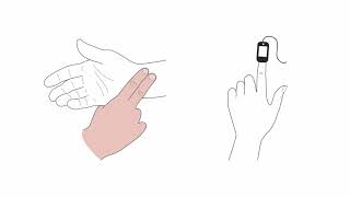 Mastering transcutaneous pacing [upl. by Ramos]