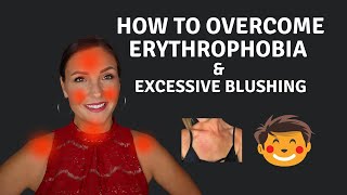 How To Cure Erythrophobia amp Excessive Blushing [upl. by Fachini]