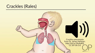 How Babies Breathe in The Womb [upl. by Arelc]