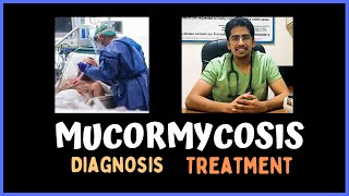 MUCORMYCOSIS Clinical features Diagnosis amp Treatment [upl. by Bron]