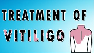 Vitiligo Symptoms Treatment and Causes [upl. by Gwen]