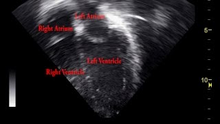 How Blood Flows Through the Heart [upl. by Mulderig]