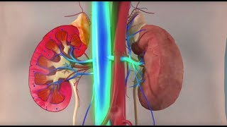 Rhabdomyolysis  an easy overview [upl. by Kwasi463]