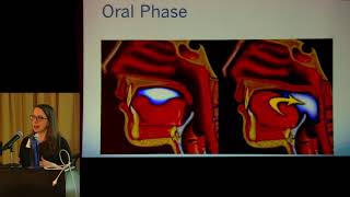 Making Connections Swallowing Therapy and the SLP [upl. by Eustache]