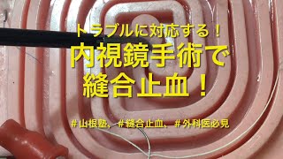 【縫合止血】左手で出血点を把持して縫合止血！【外科医必見】 [upl. by Ylle]