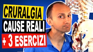 Cruralgia la Causa e 3 Esercizi di Fisioterapia [upl. by Allemap]