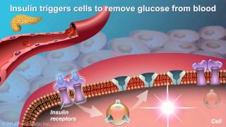 Understanding Type 2 Diabetes [upl. by Notgnimer652]