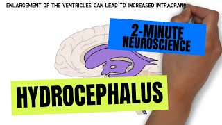 Fourth ventricle  neuroanatomy [upl. by Gaul]