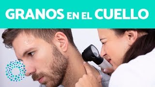 GRANOS en el CUELLO  ¿Por qué salen GRANOS en el CUELLO [upl. by Tonina]