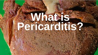 Pericardiocentesis During Cardiopulmonary Resuscitation by T Wolbrink  OPENPediatrics [upl. by Airalednac]