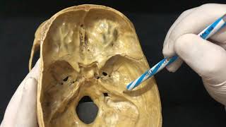 Skull Osteology  Cranial Cavity Anatomy [upl. by Cuthbertson158]